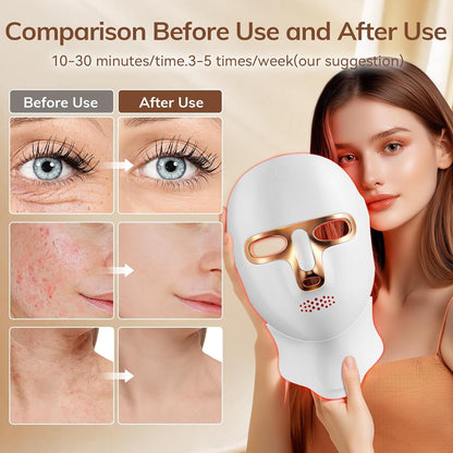 🔥Last 6 Hours 80% Off:🌸Medazy 4D Laser Light Therapy Mask