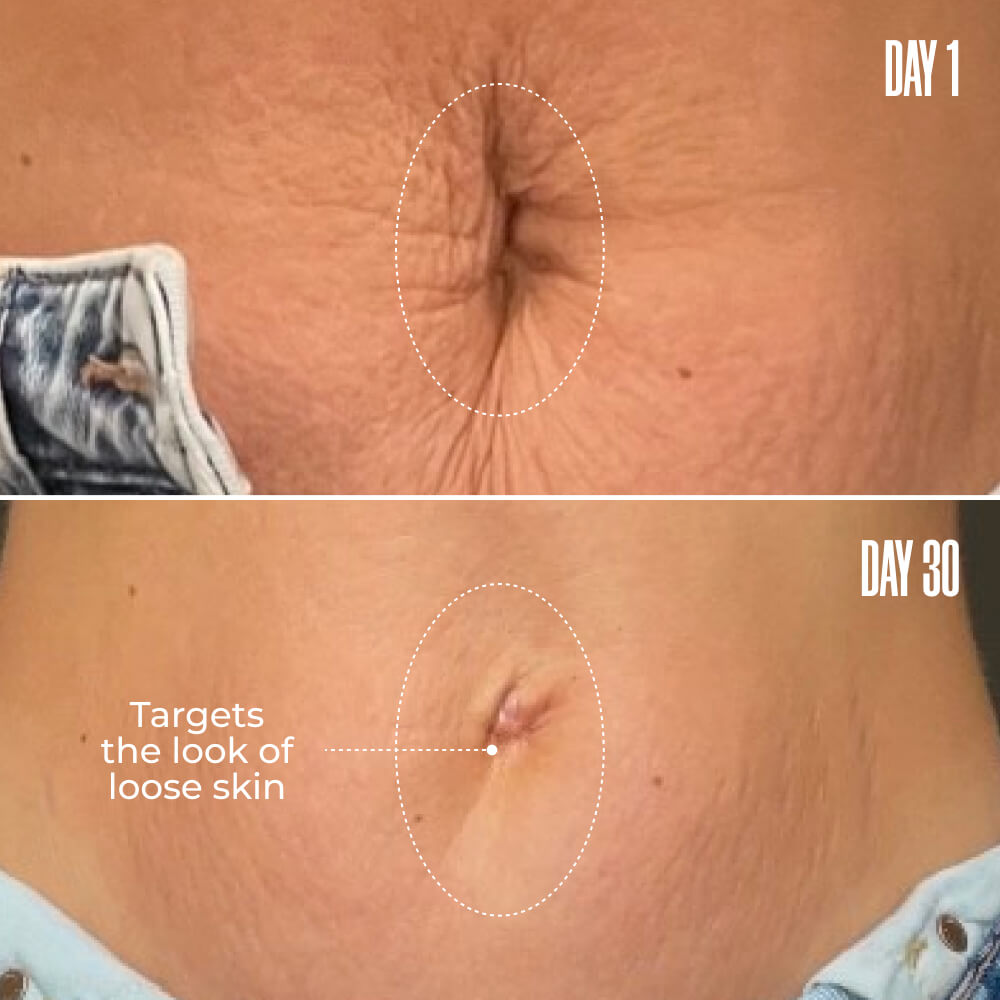 🔥LAST DAY 65% OFF🔥Medazy-B-FLAT Belly Firming Cream