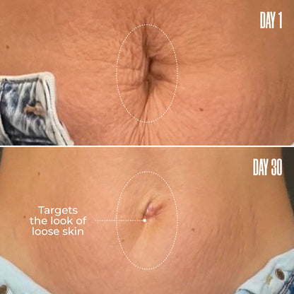 🔥LAST DAY 65% OFF🔥Medazy-B-FLAT Belly Firming Cream